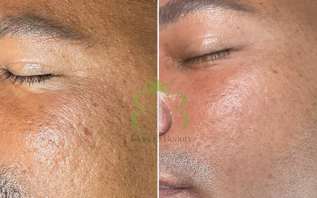 Island of Beauty Facial Spa Miramar