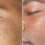 Island of Beauty Facial Spa Miramar