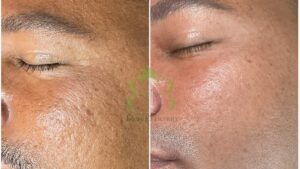 Island of Beauty Facial Spa Miramar